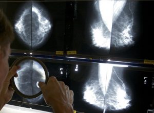 Mammograms_Standards_40501