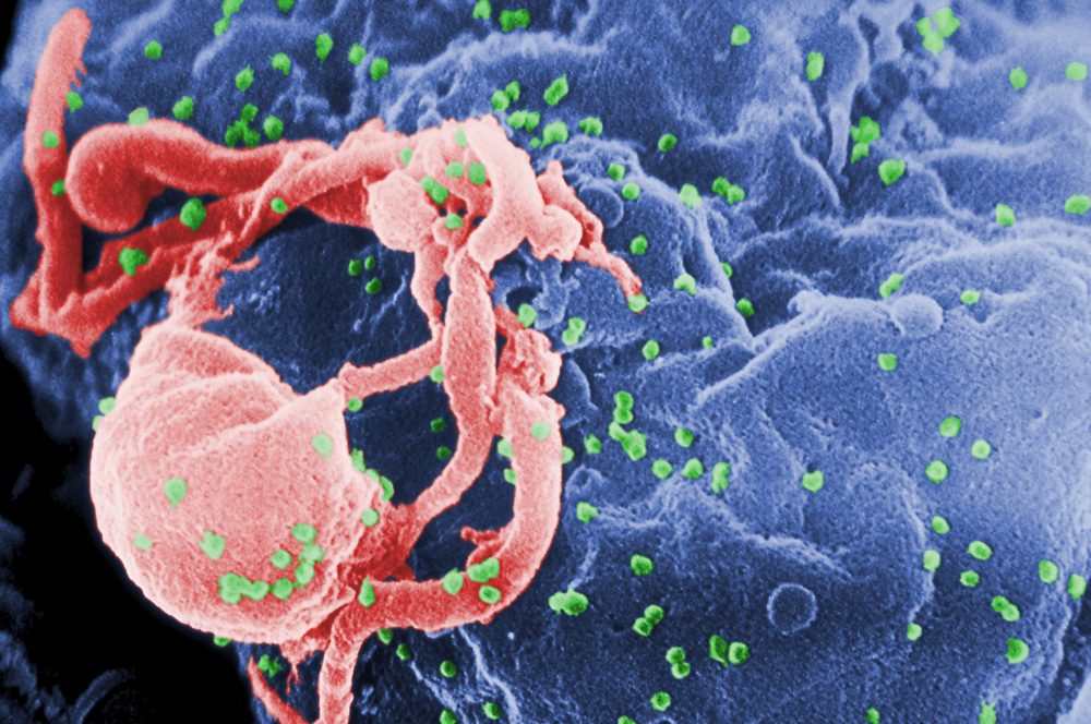HIV_Newborn_Treatment_42386