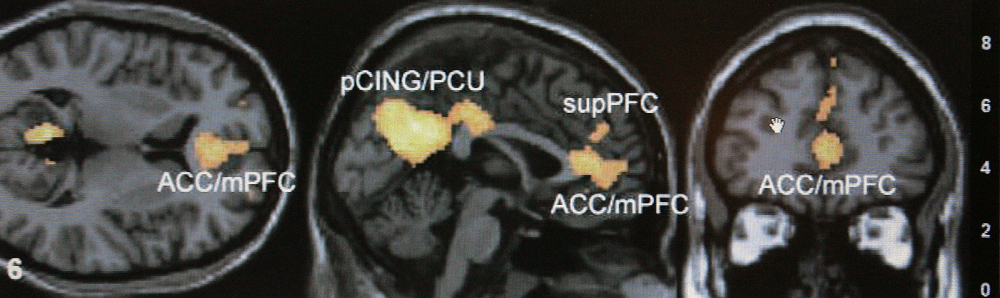 Brain_Scans_Challenged_77749