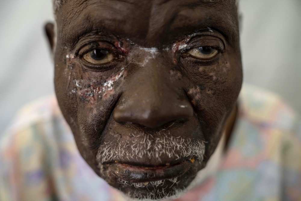 Pictures of the Week Global Photo Gallery