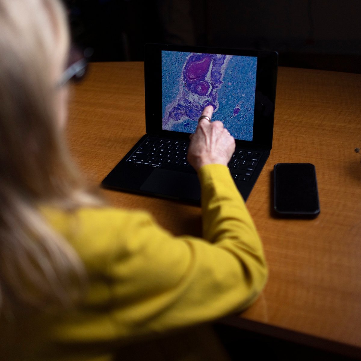 What the Lewiston shooter’s brain injury can tell us about blast exposure in the military